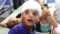 مستشفيات غزة تعاني نقصا حادا في وحـدات الدّم ومكوّناته