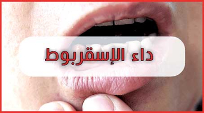 تعرّف علـى مرض الإسقربـوط؟